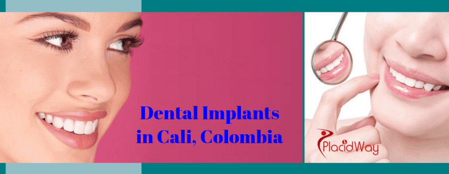 Dental Implants in Cali, Colombia